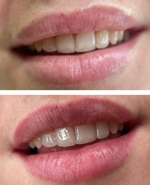 Micropigmentación Labios