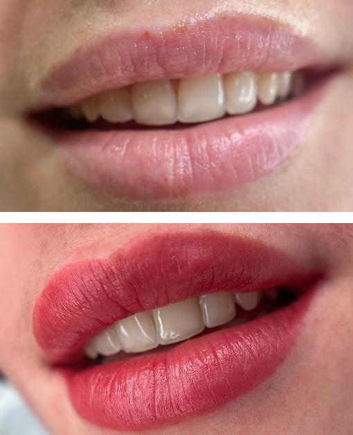 Micropigmentación Labios