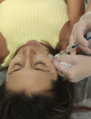 Ácido Hialurónico 6 puntos (Full Face)