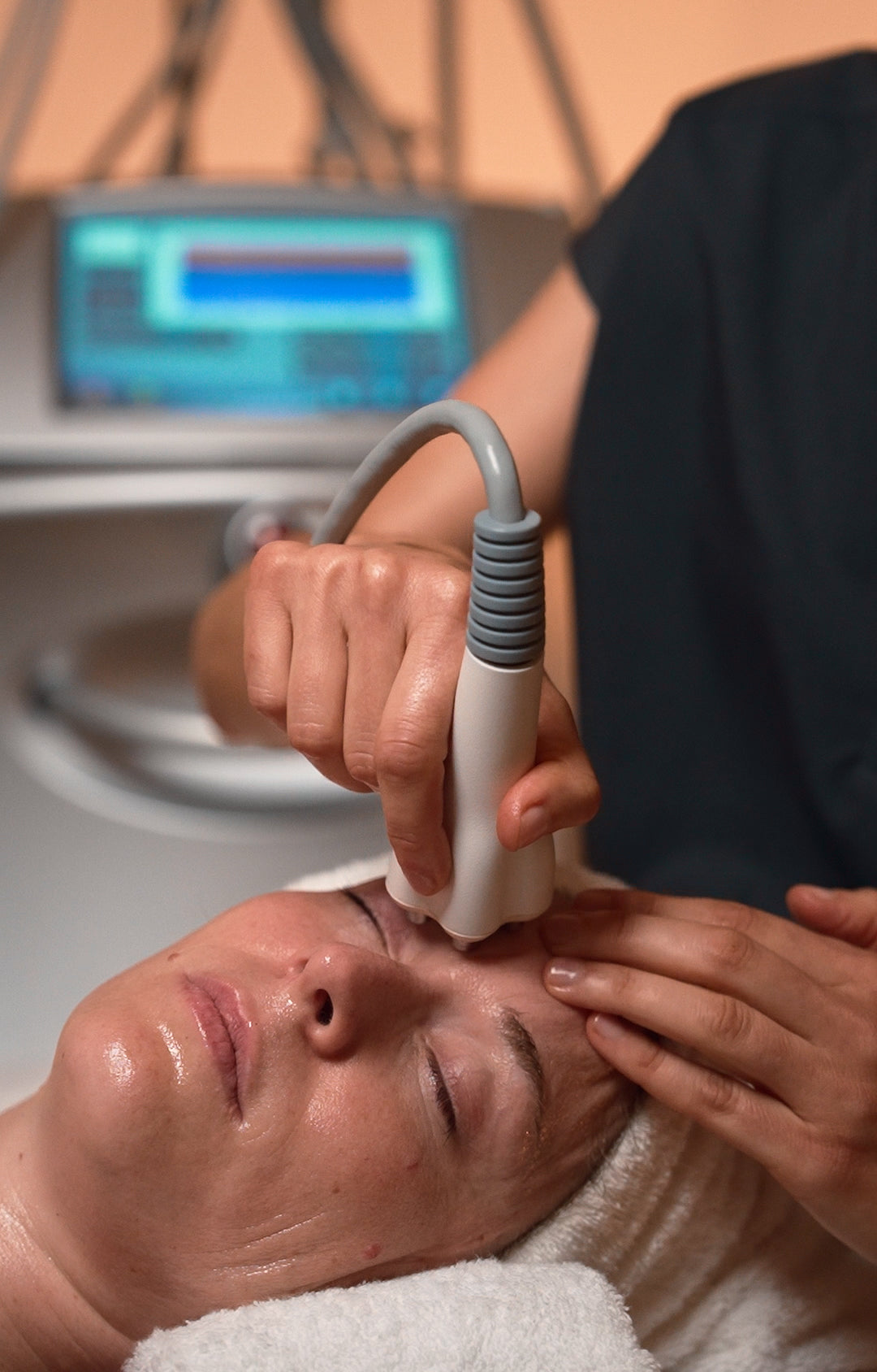 Legacy Facial Radiofrequency