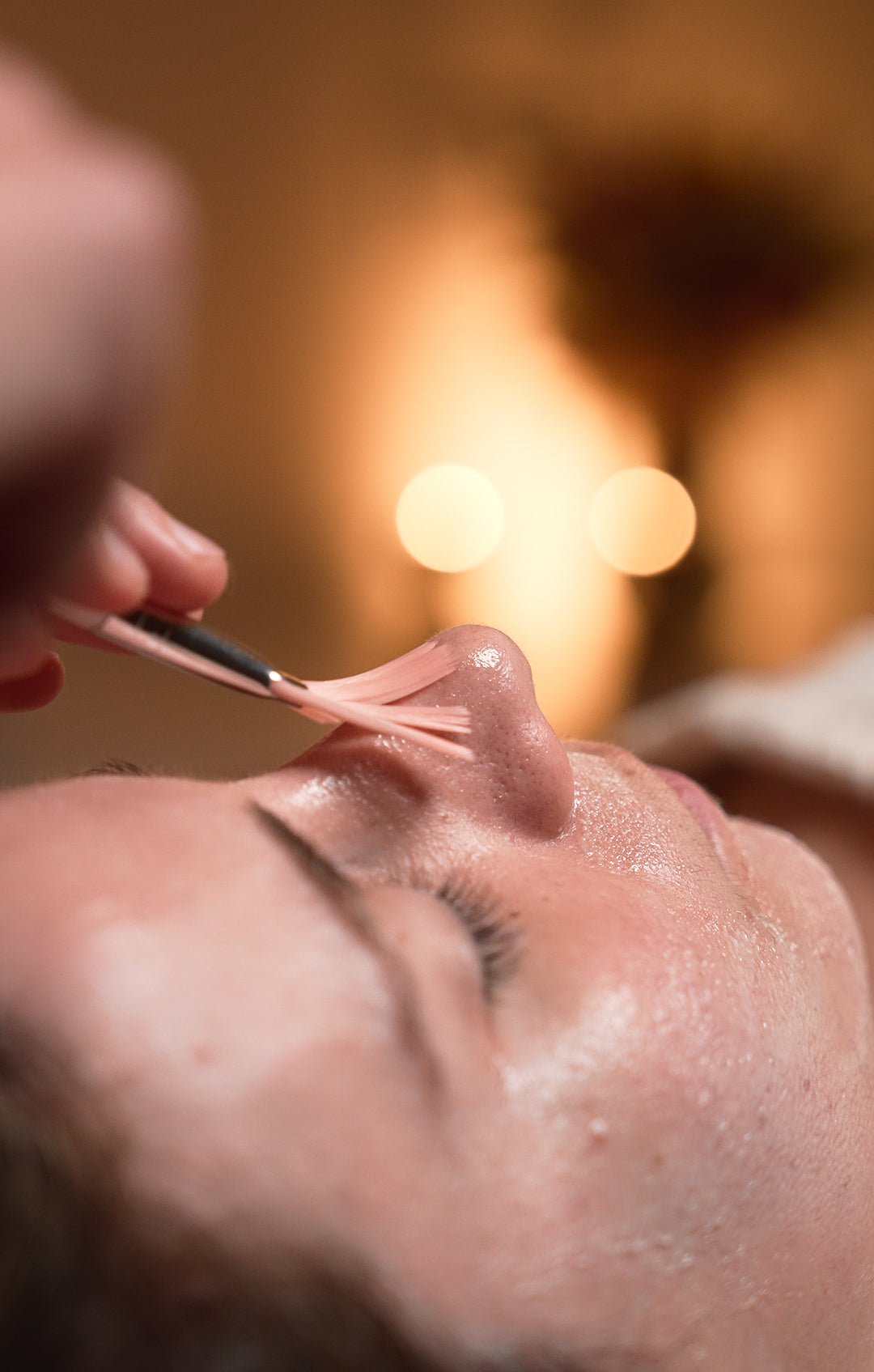 Medium-Depth Acid Peels
