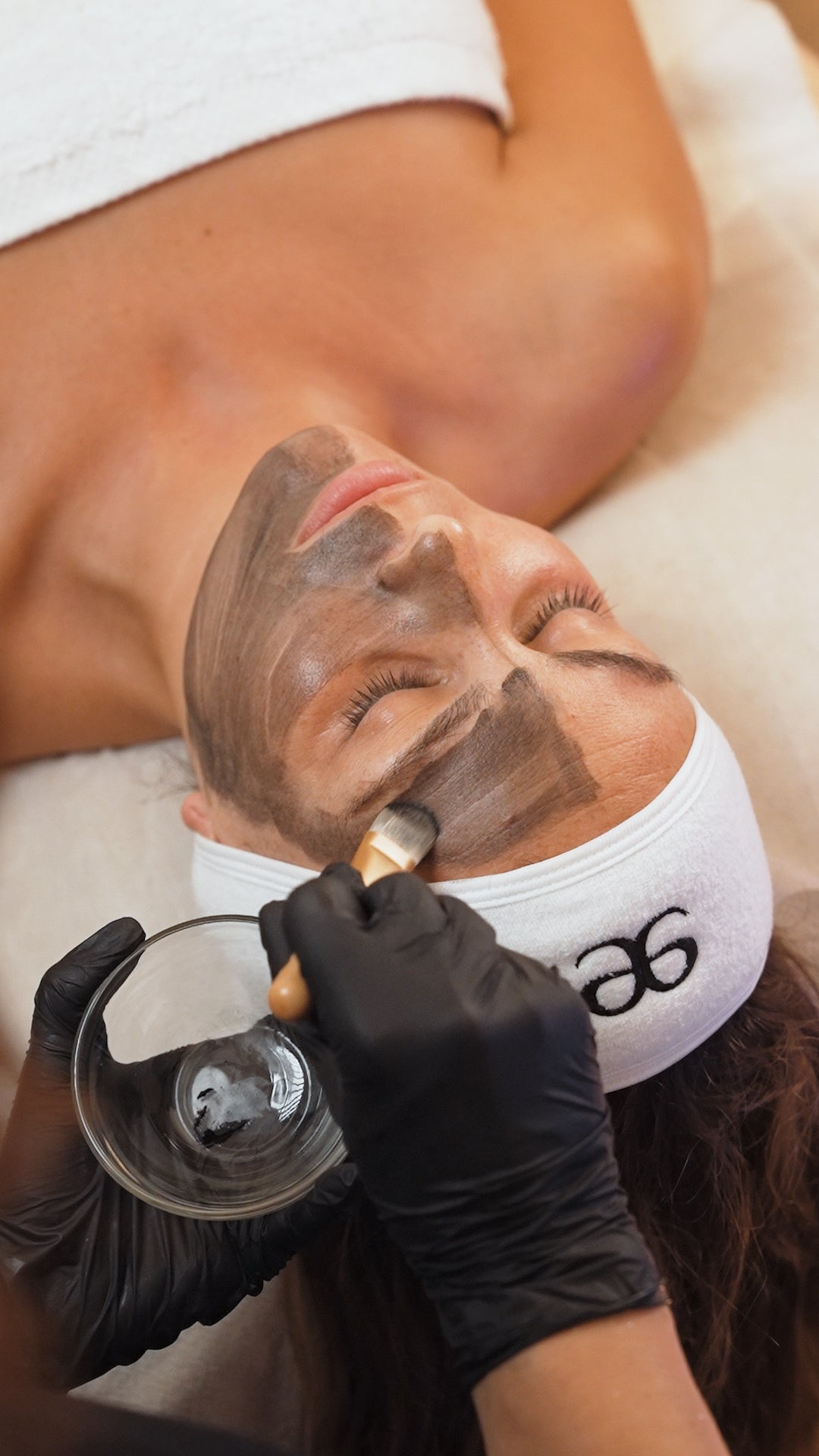 Carbon Peel