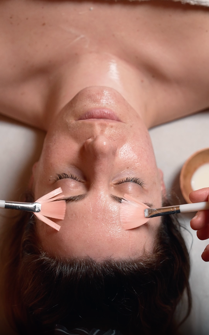 Medium-Depth Acid Peels