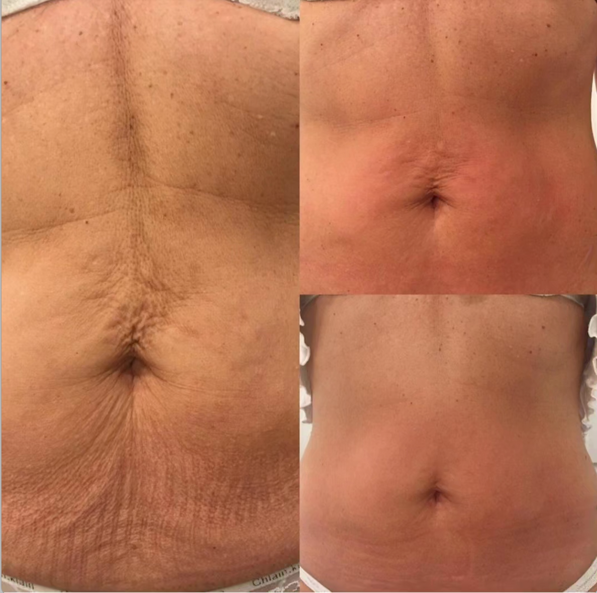 Fhos Procyon (IPL)