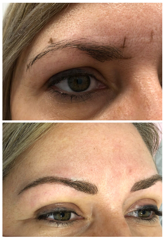 Micropigmentación Cejas