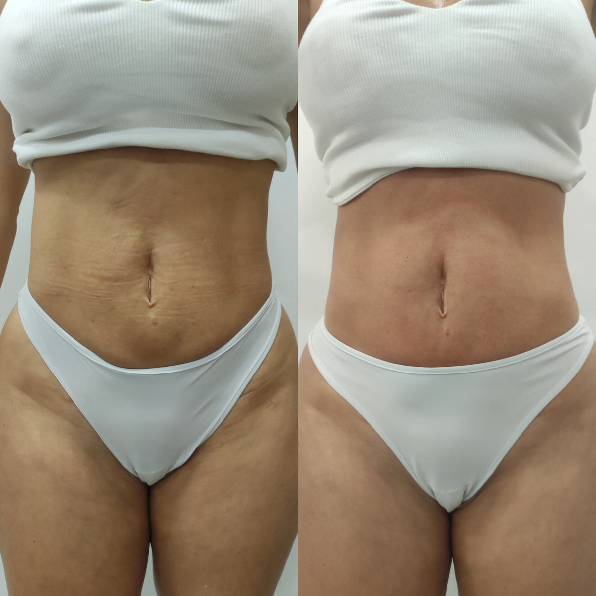 Fhos Procyon (IPL)