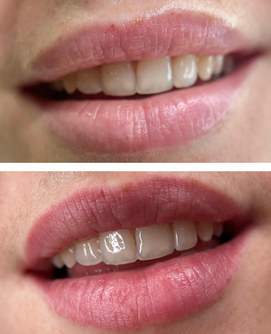 Micropigmentación Labios