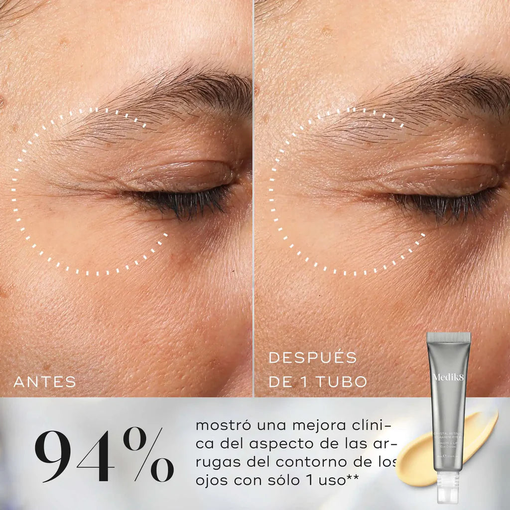 Crystal Retinal Ceramide Eye 3: Contorno de ojos antiedad con Vitamina A
