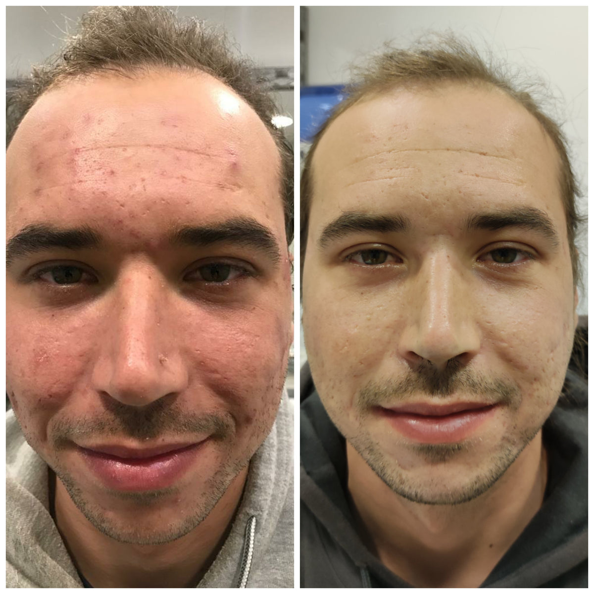 Soin du visage