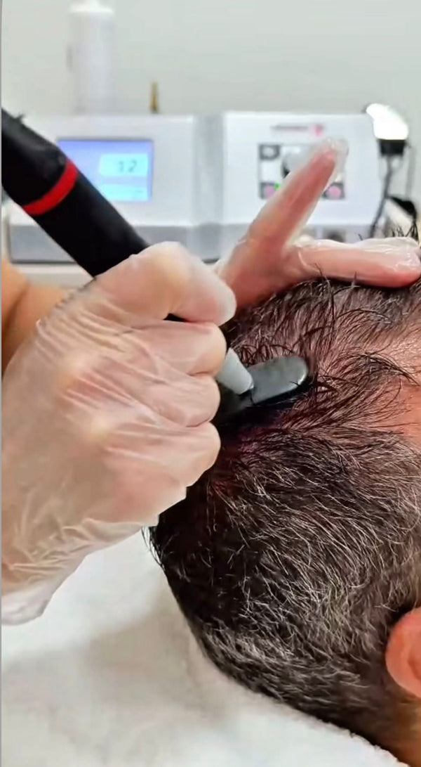 Radiofrecuencia Indiba capilar